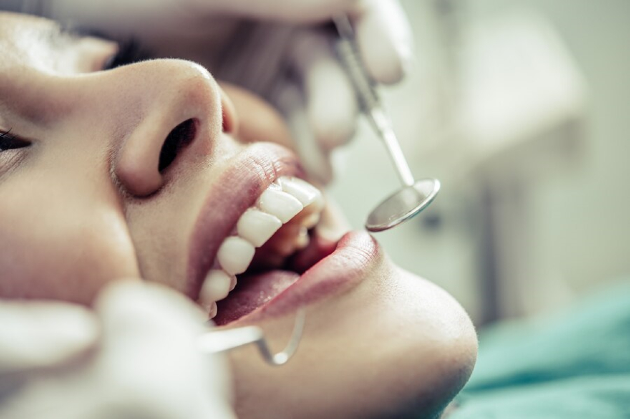 Fluoryzacja zębów - skuteczna ochrona przed próchnicą
